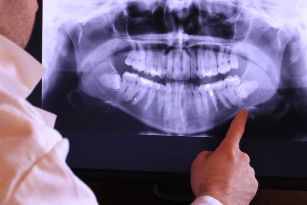 Best Emergency Dentist for Knocked-Out Tooth in Haskins, OH